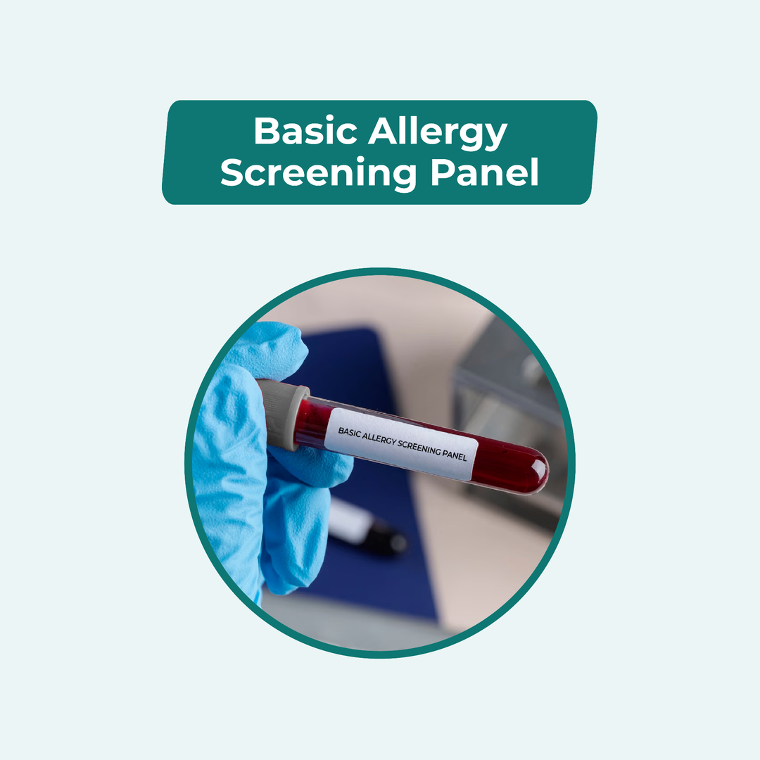 Basic Allergy Screening Panel test Online in Dhaka | Arogga Online Lab